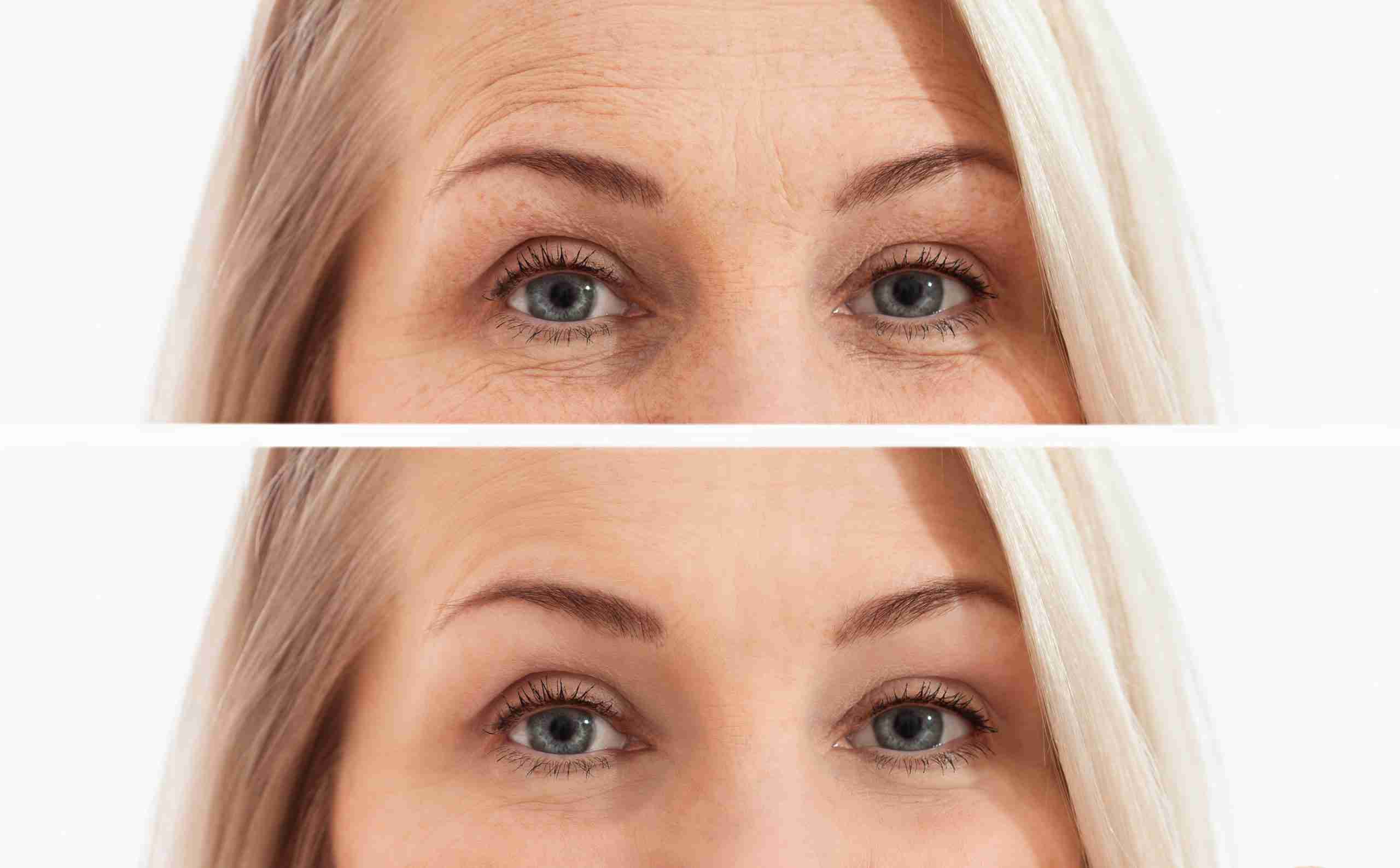 Dristi Bright Eyes Treatment Spa Organic Apoteke