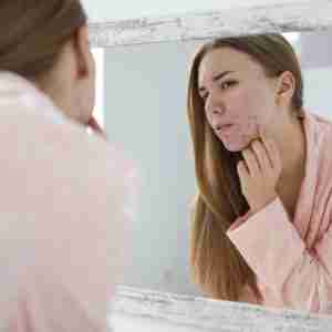 Woman looking at acne in the mirror
